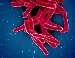Project: Fighting Against Global Tuberculosis